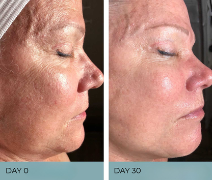 DermaLink.® Light Therapy Wand